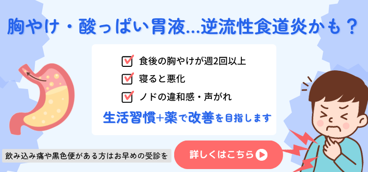 逆流性食道炎バナー